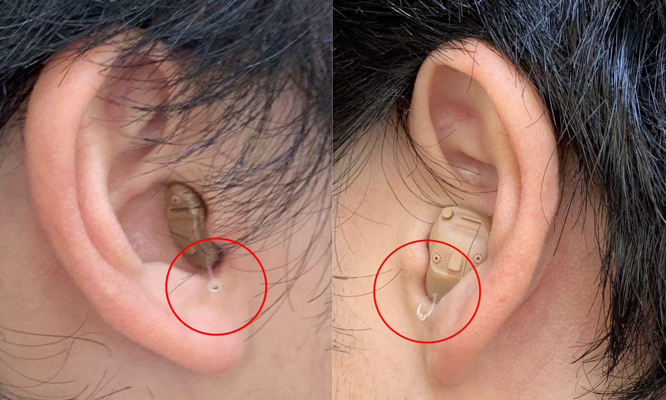 スターキー補聴器の購入方法