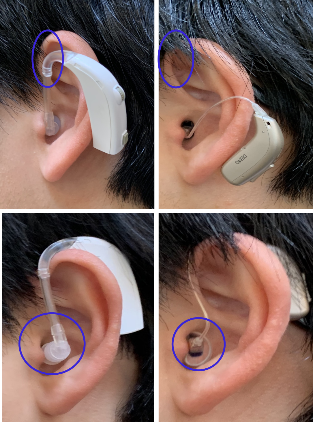 雑音 の 入ら ない 補聴器