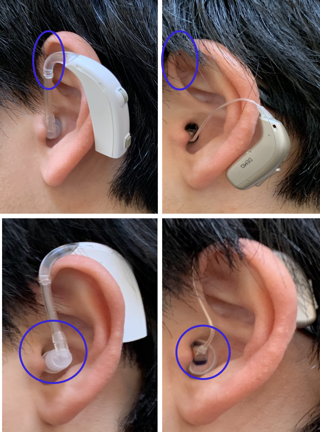 補聴器 を つける 基準